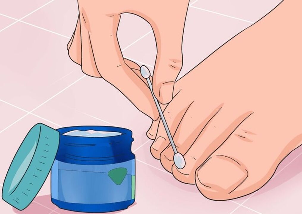 Sana hongos de uñas